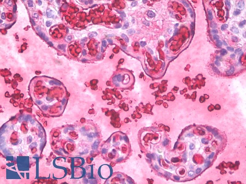 IHC-plus™ Hemoglobin Antibody (clone HB11-231.2)
