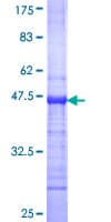 Human BLIMP1 / PRDM1 Protein (Recombinant GST, N-terminus)