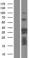 Human PSRC1 / DDA3 Protein (Over-Expression Lysate Myc-DDK (Flag))