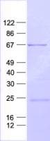 Human SOCS5 Protein (Recombinant His, N-Terminal)