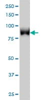 TLK1 Antibody (clone 4B3)