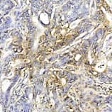 Heat Shock Protein 70 / HSPA1A Antibody (clone C92F3A-5)