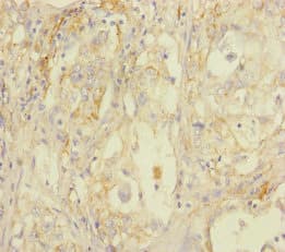 Polyclonal Rabbit anti-Human STOML2 Antibody (IHC)