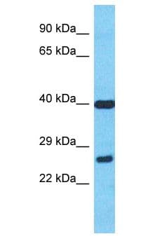 MIEF2 / SMCR7 Antibody (aa51-100)