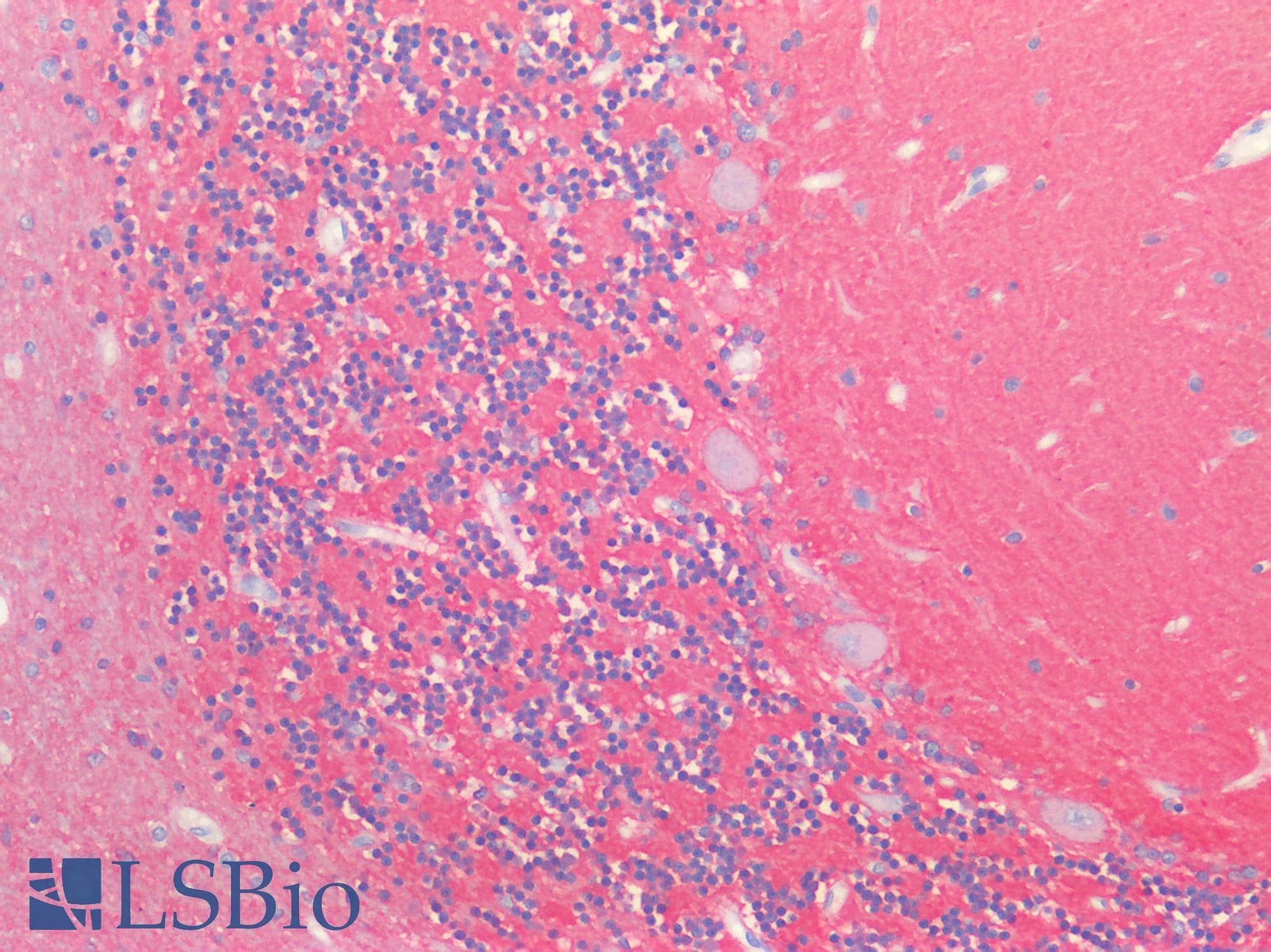 PathPlus™ NCAM / CD56 Antibody