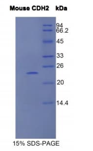 Mouse CDH2 / N Cadherin Protein (Recombinant His)