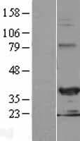 CHF1 / HEY2 Protein (Over-Expression Lysate Myc-DDK (Flag))