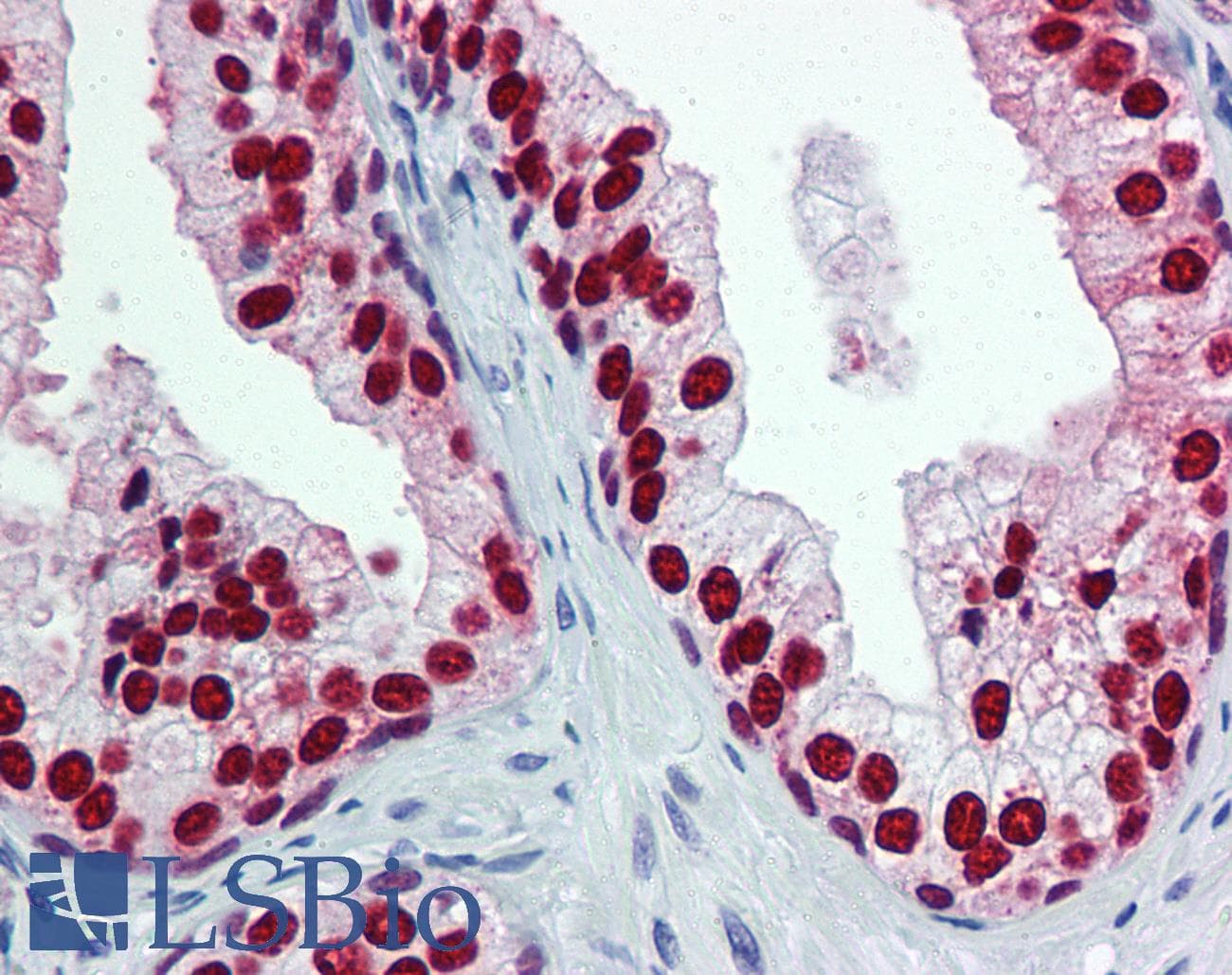 PathPlus™ FOXA1 Antibody (clone 3C1)