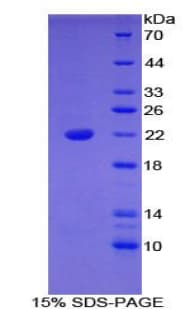 Mouse BLMH Protein (Recombinant His-S)