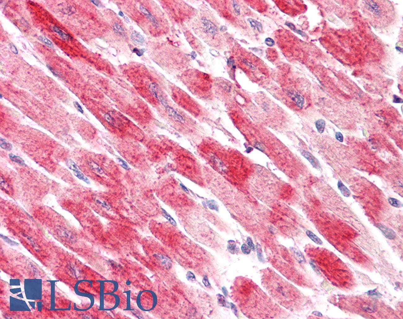 IHC-plus™ Polyclonal Goat anti-Human CFL2 / Cofilin 2 Antibody (aa142-152, IHC, WB)