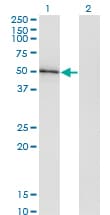 HAVCR1 / KIM-1 Antibody (clone 2G11)