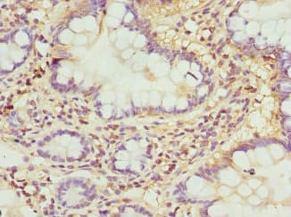 RASGRF1 / CDC25 Antibody