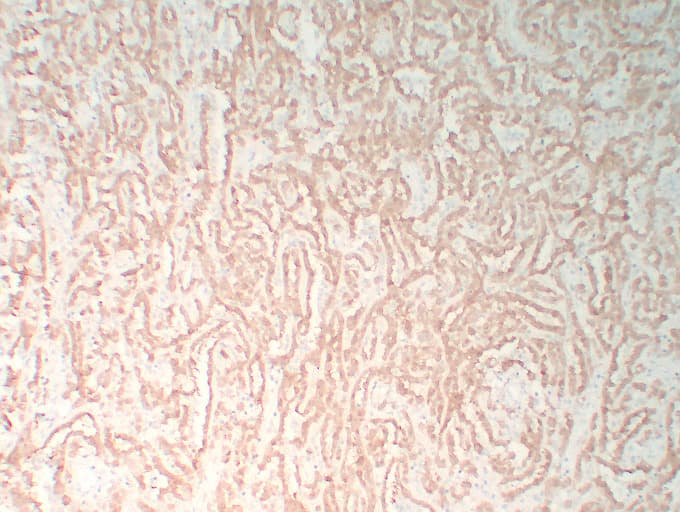 CALB2 / Calretinin Antibody (clone ABT-Calret 1)