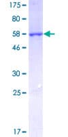 Human CBR / CBR1 Protein (Recombinant GST)