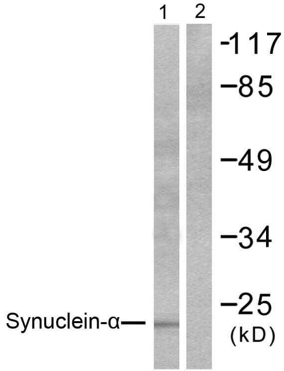 SNCA / Alpha-Synuclein Antibody (p133)