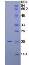 Rat CD69 Protein (Recombinant His)