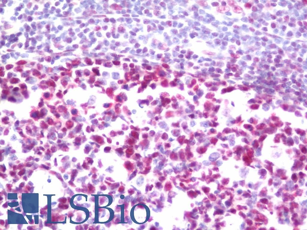 IHC-plus™ HNRNPH1 / hnRNP H Antibody (aa400-C-term)