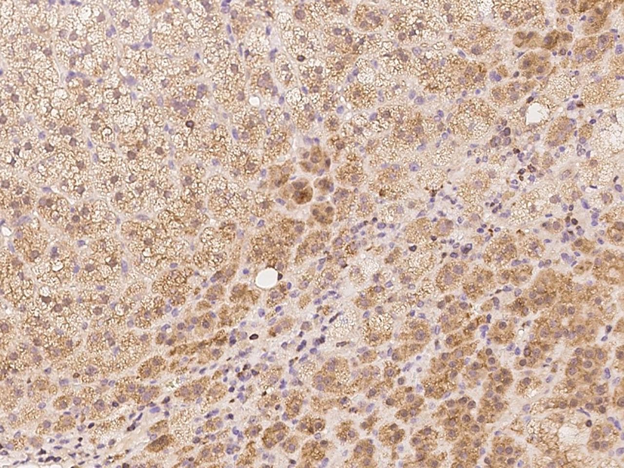 TRIM23 Antibody
