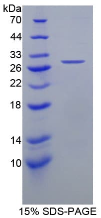Human HDLBP / Vigilin Protein (Recombinant His-T7)