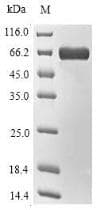 Pyrococcus horikoshii Tr:g608530 G608530 L-aspartate Oxidase. ; Protein (Recombinant 10His-SUMO, N-terminus + Myc, C-terminus)