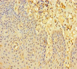 LMO2 Antibody