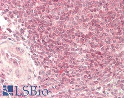 ERIC-1 / TACC3 Antibody (aa503-552)