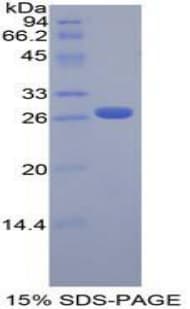 Mouse FGFRL1 Protein (Recombinant His-T7)