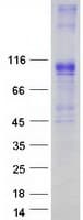 Human SLC4A1 / Band 3 / AE1 Protein (Recombinant Myc-DDK (Flag))