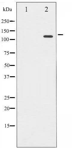 Polyclonal Rabbit anti-Human RB1 / Retinoblastoma / RB Antibody (phospho-Ser780, IHC, WB)