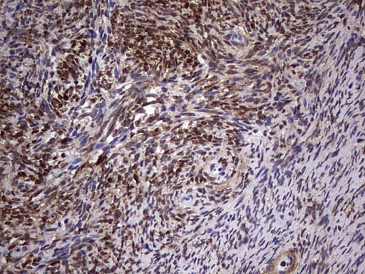 MYF5 / MYF 5 Antibody (clone OTI2G5)
