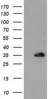 Monoclonal Mouse anti-Human SULT1A1 / Sulfotransferase 1A1 Antibody (clone OTI5F1, IHC, IF, WB)