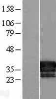 FAM84B Protein (Over-Expression Lysate Myc-DDK (Flag))