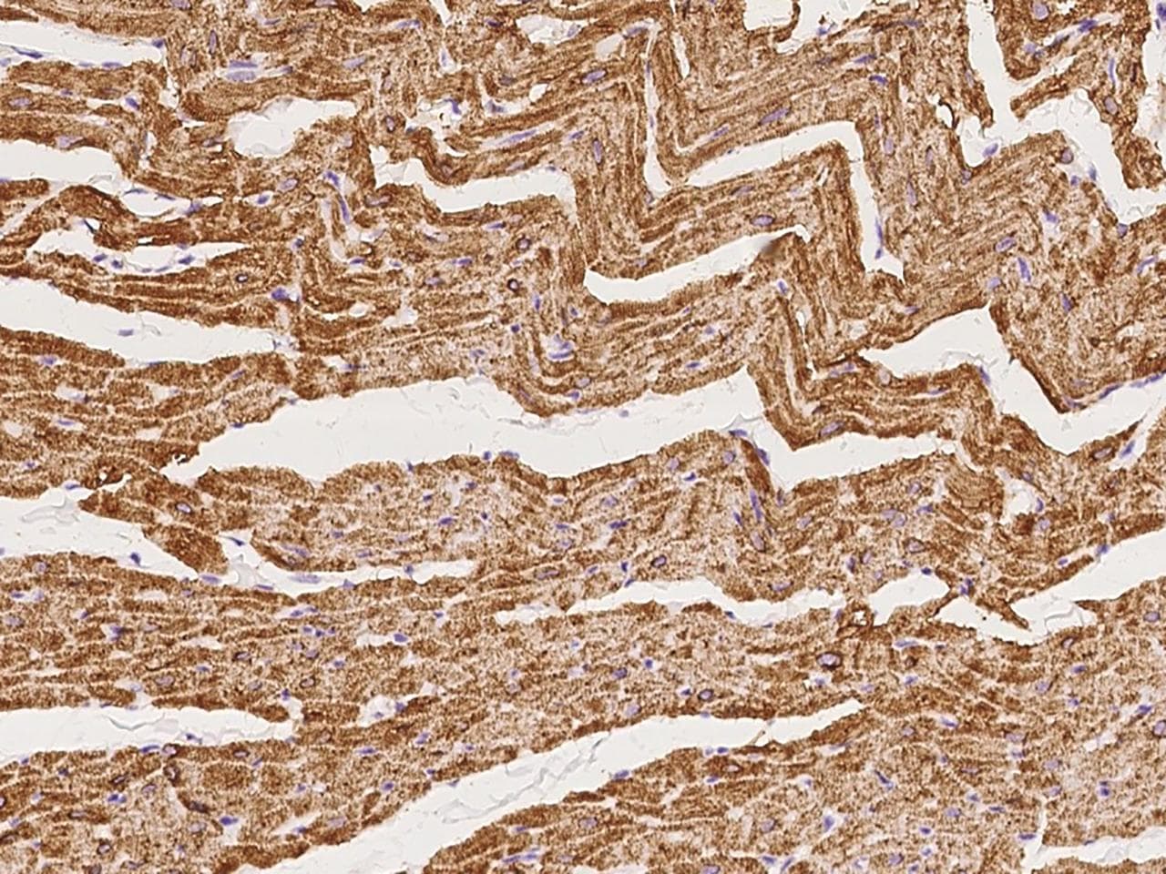 Polyclonal Rabbit anti-Human PLN / Phospholamban Antibody (IHC)