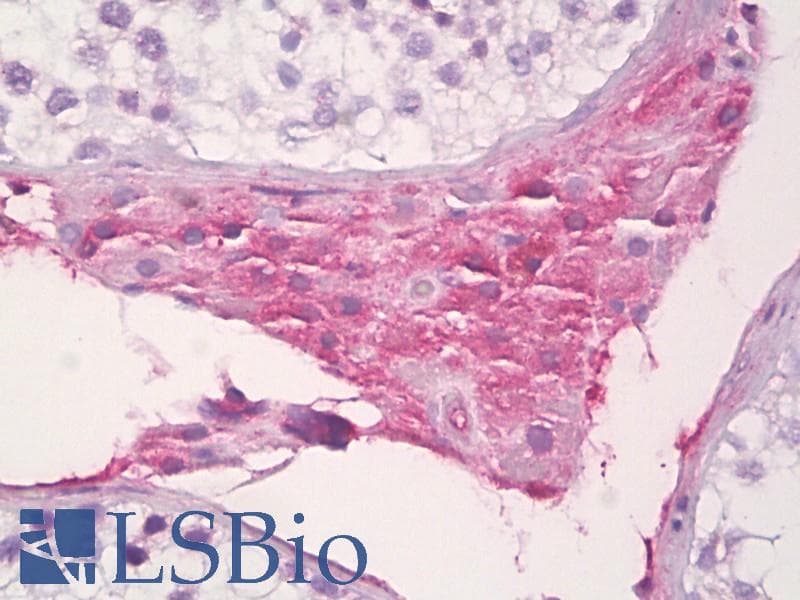 IHC-plus™ SAA4 Antibody (aa81-130)