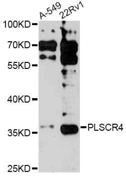 Polyclonal Rabbit anti-Human PLSCR4 Antibody (WB)