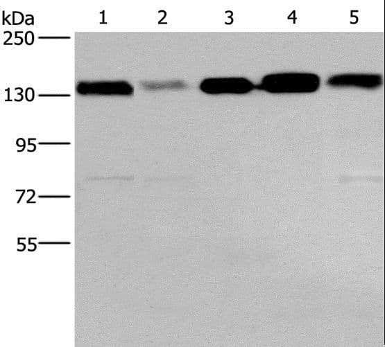 Polyclonal Rabbit anti-Human CEP97 Antibody (IHC, WB)