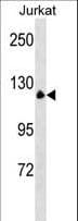 Polyclonal Rabbit anti-Human MYT1 Antibody (aa1-30, WB)