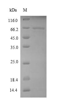 Human EEF1A1 Protein (Recombinant 6His-SUMO, N-terminus)