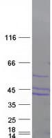 Human SEPHS2 Protein (Recombinant Myc-DDK (Flag))