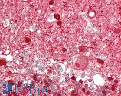 PathPlus™ NOS2 / iNOS Antibody (90-170 aa)
