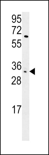 KIR2DS3 Antibody (aa268-295)