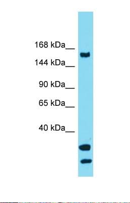 Polyclonal Rabbit anti-Human USP54 Antibody (C-Terminus, WB)