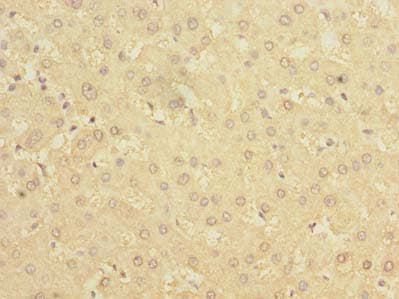 Polyclonal Rabbit anti-Human BDH2 Antibody (IHC)