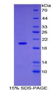 Mouse MMP9 / Gelatinase B Protein (Recombinant His)