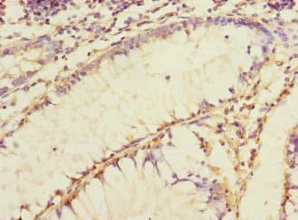JCHAIN / Ig J Chain Antibody