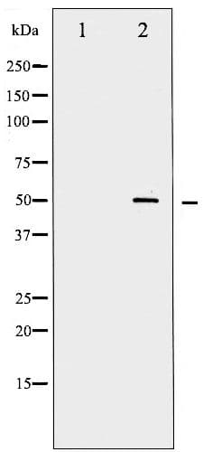 MYC / c-Myc Antibody (phospho-Ser62)
