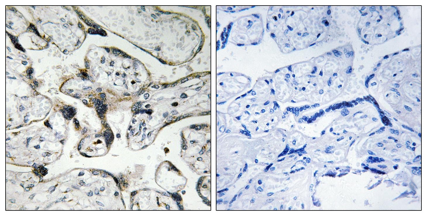 PAK1 / PAK2 Antibody (p199)
