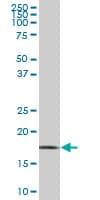 Monoclonal Mouse anti-Human WRB Antibody (clone 4D6, WB)