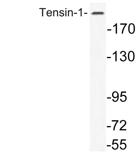 TNS1 / Tensin-1 Antibody (aa1273-1322)