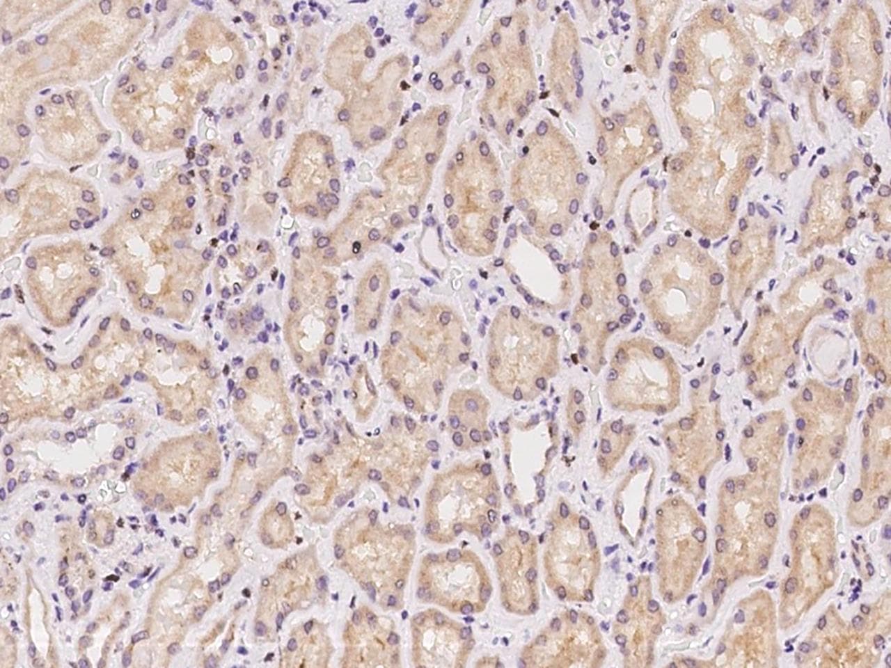 PPIP5K2 / HISPPD1 Antibody